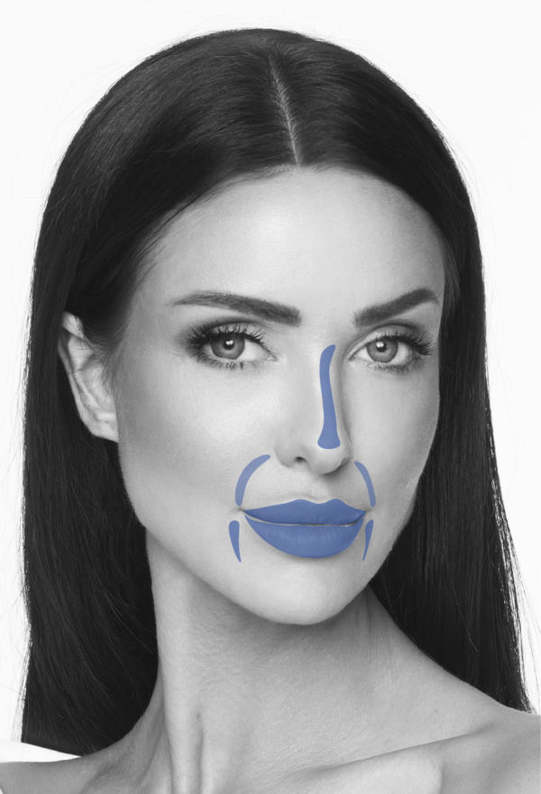 short date infini premium filler l+ lidocaine short date infini premium filler l+ lidocaine